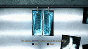 Silent Hill: Homecoming | PlayStation 3 | gameplay screenshot | region=North America | source-country= | zypher-v2 | moby-8a6bea5c67bb | Data by MobyGames.com